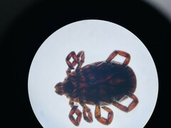 Ixodidae