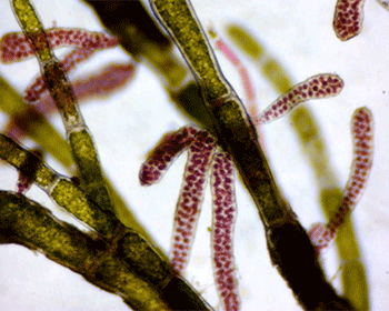 Representative image of Stylonema cornu-cervi