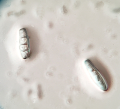 Cresponea chloroconia