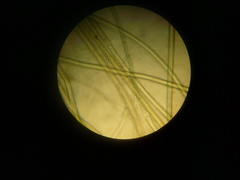 Cladophora globulina