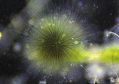 Gloeotrichia echinulata