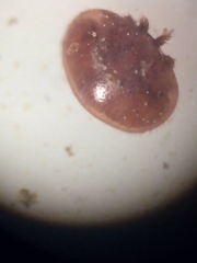 Varroa