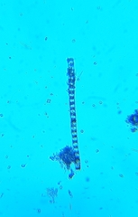 Desmidiaceae