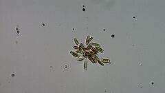 Achnanthidium