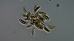 Achnanthidium