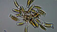 Achnanthidium