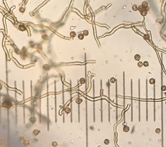 Disciseda subterranea