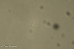 Amoebozoa