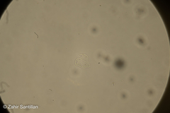 Amoebozoa