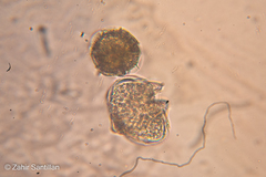 Amoebozoa