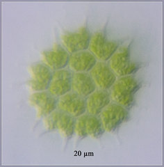 Pseudopediastrum boryanum