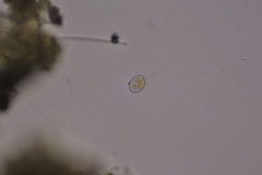 Cocconeis placentula