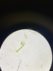 Hydrozoa