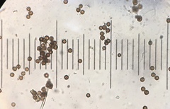 Disciseda subterranea