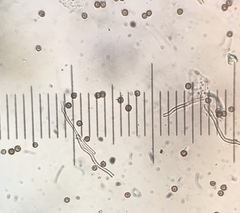 Disciseda subterranea