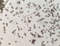 Disciseda subterranea