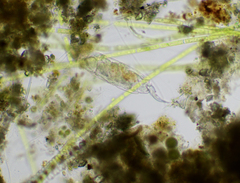 Cephalodella forficula