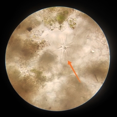 Protozoa