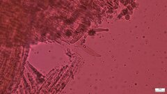 Strobilurus stephanocystis