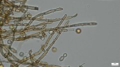 Botryobasidium