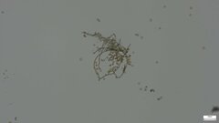 Botryobasidium