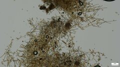Botryobasidium
