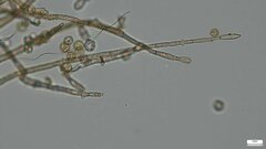 Botryobasidium