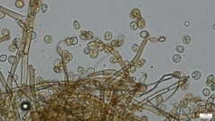 Botryobasidium