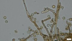 Botryobasidium
