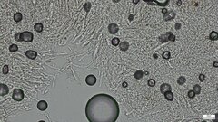 Pezizomycetes
