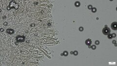 Pezizomycetes