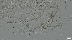 Fungi