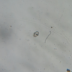 Cosmarium