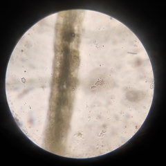 Protozoa