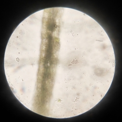 Protozoa