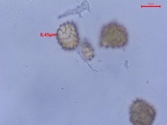 Fossombronia pusilla