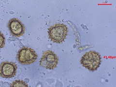 Fossombronia pusilla