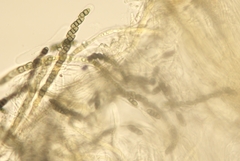 Melanomma pulvis-pyrius
