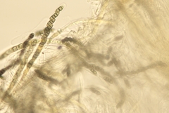 Melanomma pulvis-pyrius