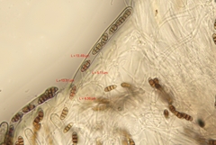 Melanomma pulvis-pyrius