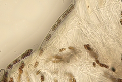 Melanomma pulvis-pyrius