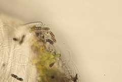 Melanomma pulvis-pyrius