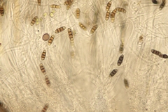 Melanomma pulvis-pyrius