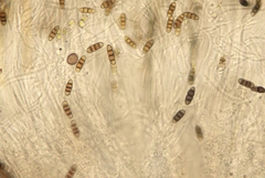 Melanomma pulvis-pyrius