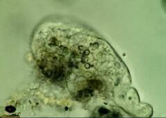 Trithigmostoma cucullulus