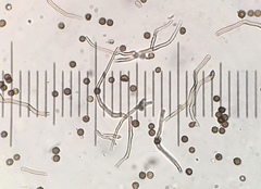 Disciseda subterranea