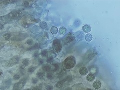 Laccaria laccata