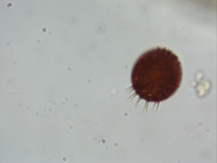 Trachelomonas armata