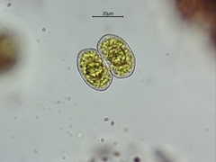 Cosmarium pseudoprotuberans