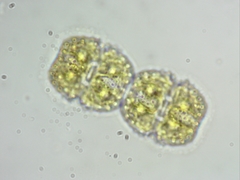 Cosmarium margaritiferum